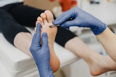 Podolog Kraków Szkolenia Podologiczne w Krakowie